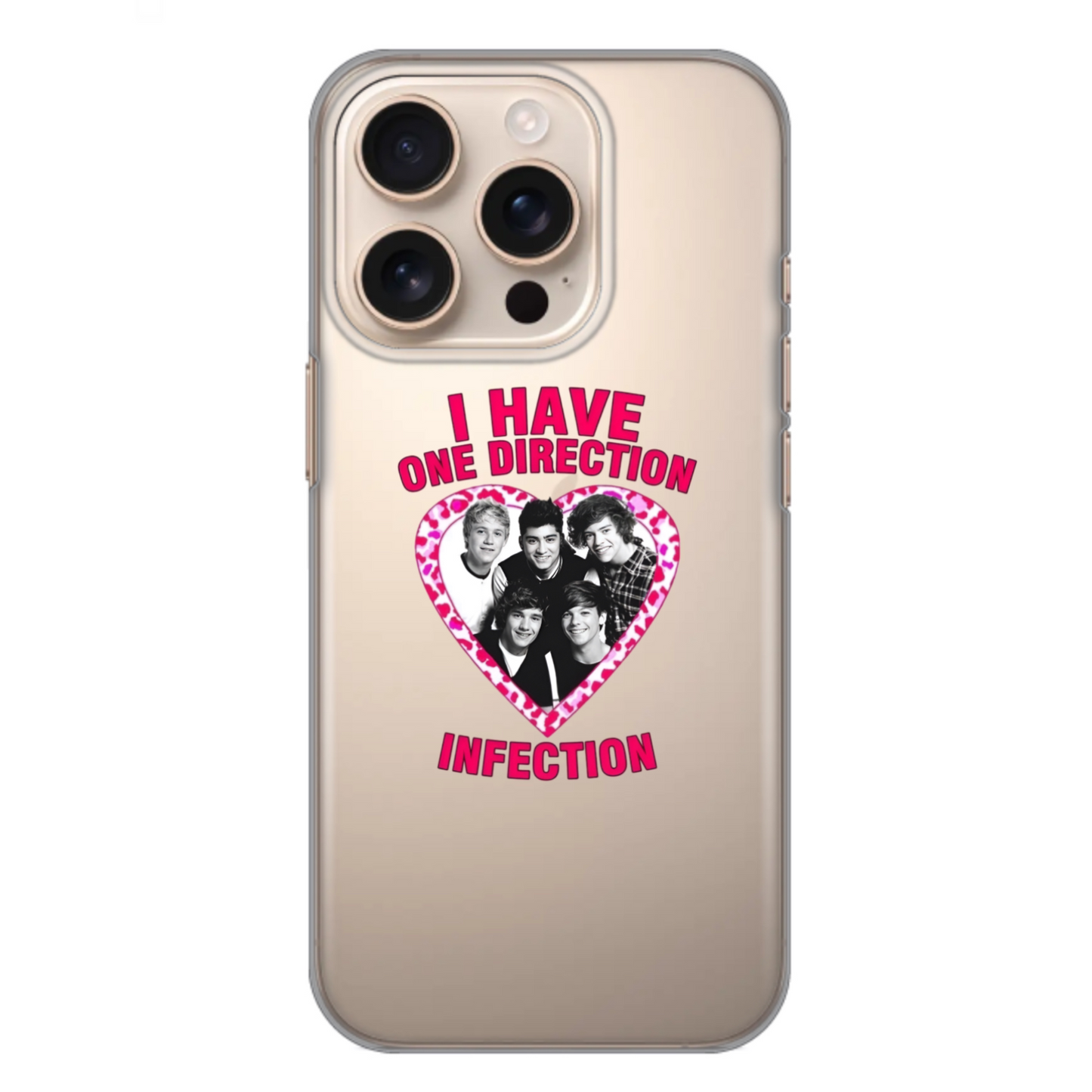 I Have One Direction Infection Phone Case